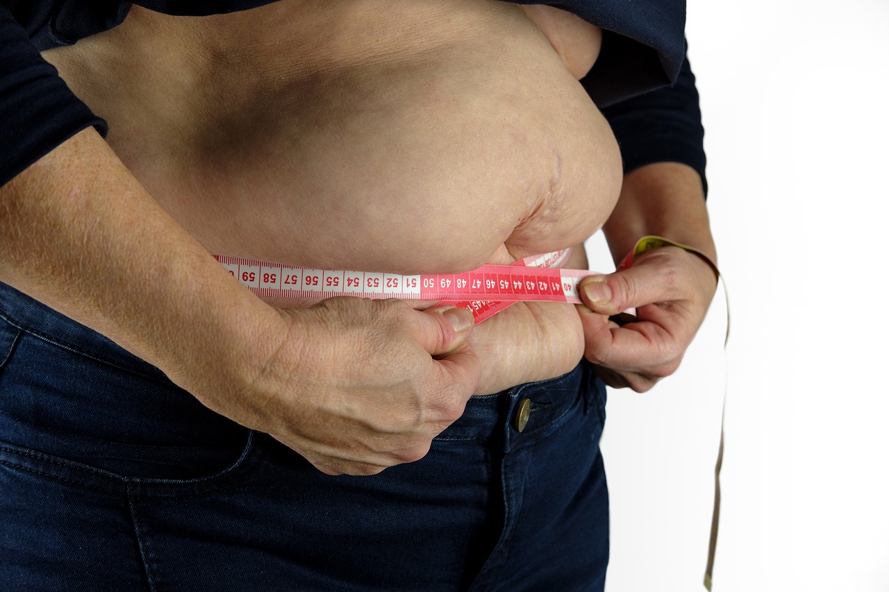 weight loss surgery in Ludhiana